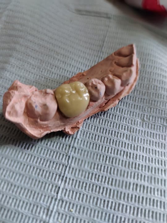 مركز ابتسامة لزراعة وتقويم الاسنان
