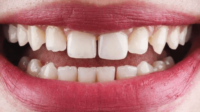 Dr.Ahmed Gouda Dental Care ((suzanna))