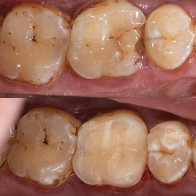 Rose dental clinic عيادة روز لطب الأسنان