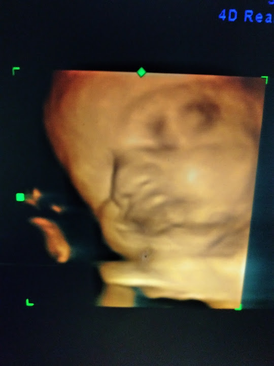 dr.salah subbah consultant in obstetrics and gynecology