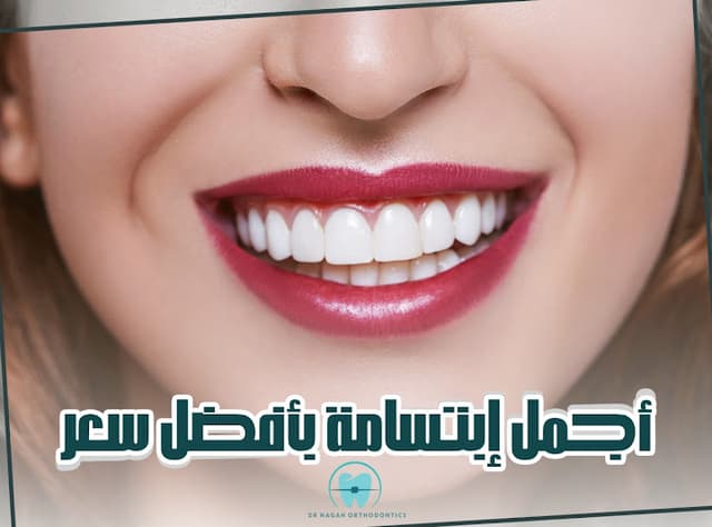 د.نجاح لتقويم الاسنان وعلاج تشوهات الفكين