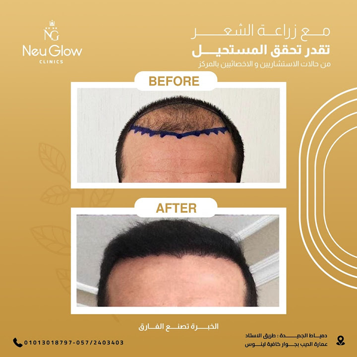 neu glow clinics