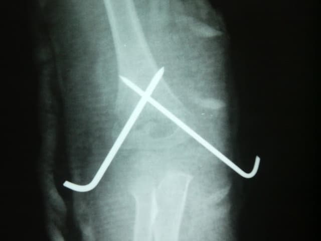 Orthopaedic Clinic (Dr.Ibrahim El-Sherbiny)