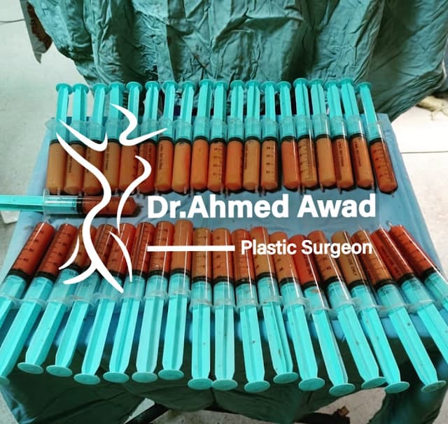 د أحمد عوض أخصائي جراحة التجميل و الحروق والليزر وزراعة الشعر