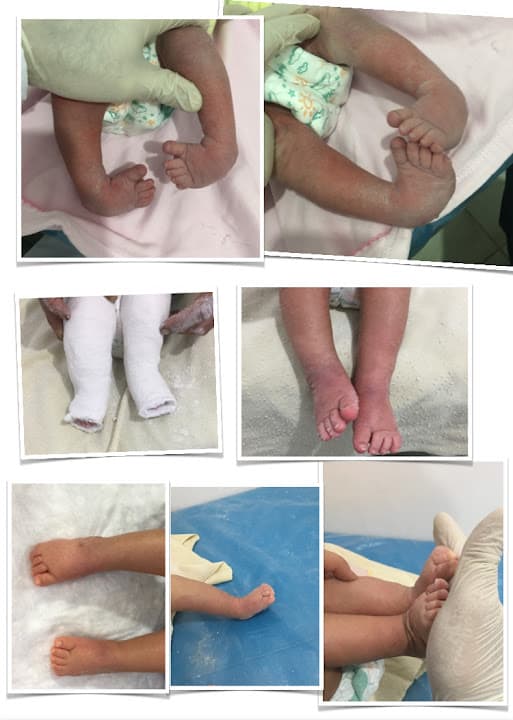 عيادة دكتور نور محمد ابراهيم أخصائي جراحة العظام و عظام الأطفال