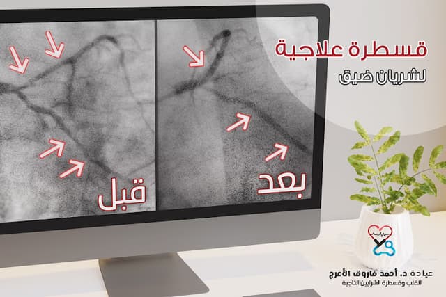 عيادة الدكتور احمد فاروق الاعرج للقلب وقسطرة الشرايين التاجية
