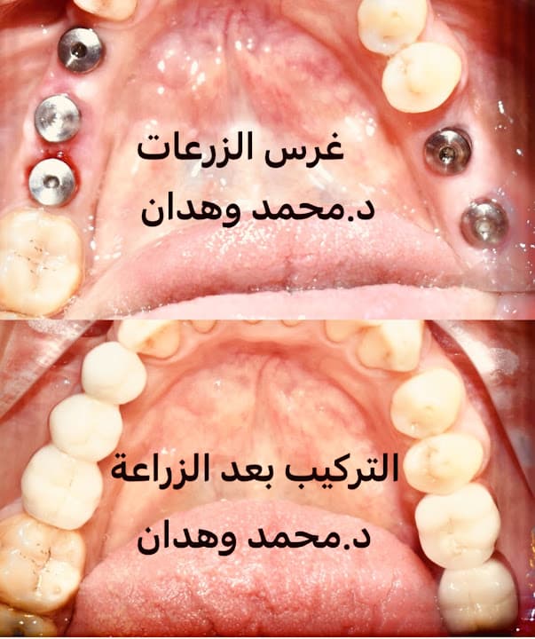 مركز د.محمد وهدان لعلاج وتجميل الاسنان بحدائق الاهرام wahdan dmc