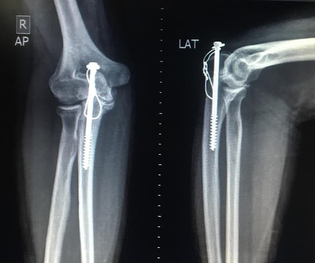 مركز الاستاذ الدكتور عادل رفعت عبيه لجراحة العظام و الكسور ALEXANDRIA ORTHOPEDIC SURGERY CENTER