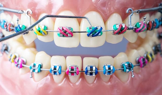 smile of hope dental center - مركز ابتسامة الامل لطب الاسنان
