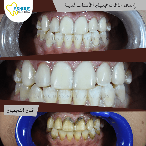 Dr. Mohammed Arnous Center for Cosmetic Dentistry