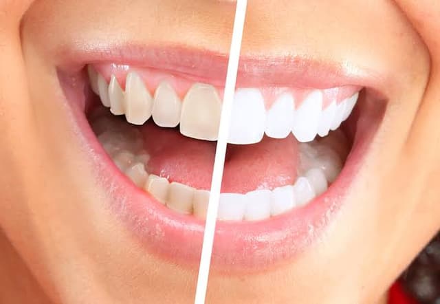 DR.AHMED ALGOHARY DENTAL CLINIC د.احمد الجوهري