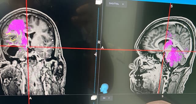 د/محمود على عباسي/إستشاري جراحة المخ والاعصاب كلية الطب بجامعة الأسكندرية