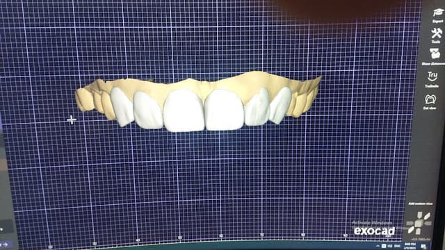 Smile Dental Centerد.عبدالعاطي جمال