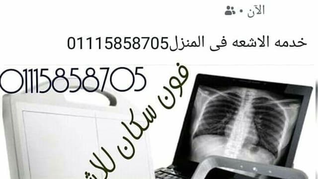 اشعه