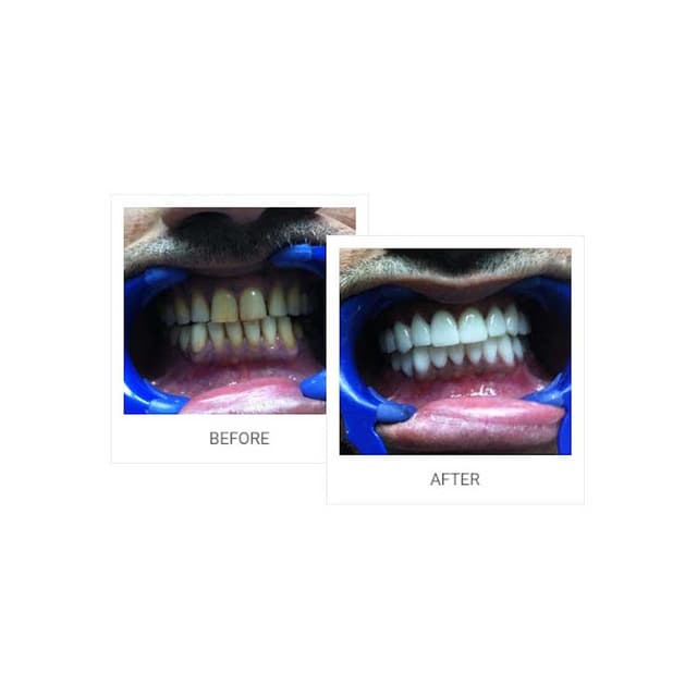 مركز لبنان للأسنان د.سهير الشافعي - Lebanon Dental Clinic - Dr. Soheir El Shafei