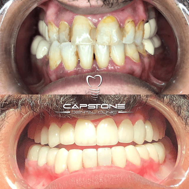 CAPSTONE DENTAL CLINIC