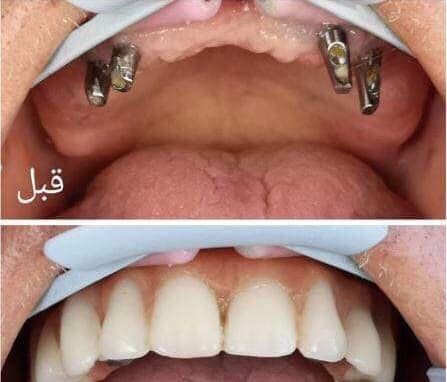 Hayat clinic - عيادة حياة
