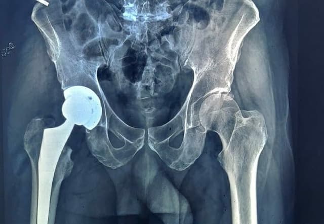 Dr Mohamed Aesam Orthopaedic clinic عيادة دكتور محمد عصام اخصائي جراحة العظام بمعهد ناصر والمستشفى الجوي التخصصي