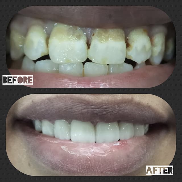 عيادة دكتور مجدي نخنوخ رفق لطب الاسنان(dental care aswan)