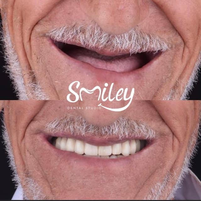 Smiley dental studio (Dr.Abdelrhman tarek) عيادات سمايلي لزراعة و تقويم الاسنان