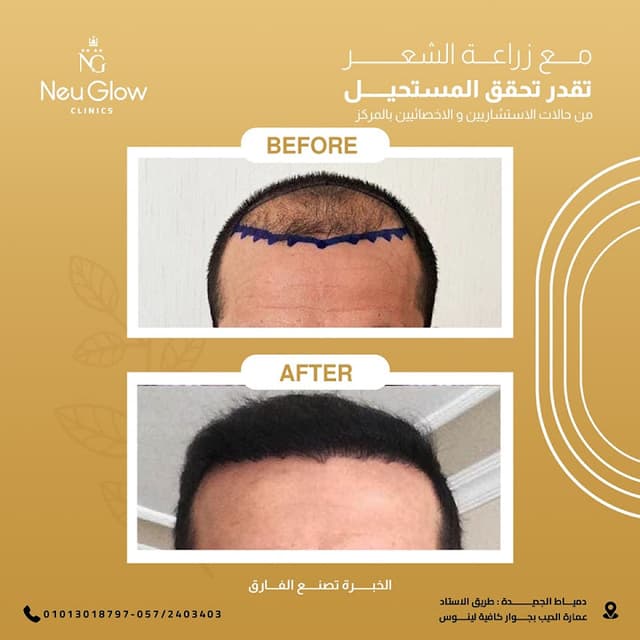 neu glow clinics